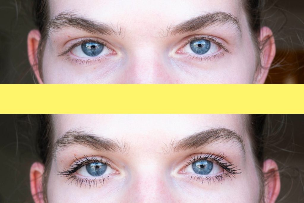 Volumen je najveći beauty trend leta - znamo kako da ga postignete 5 before after