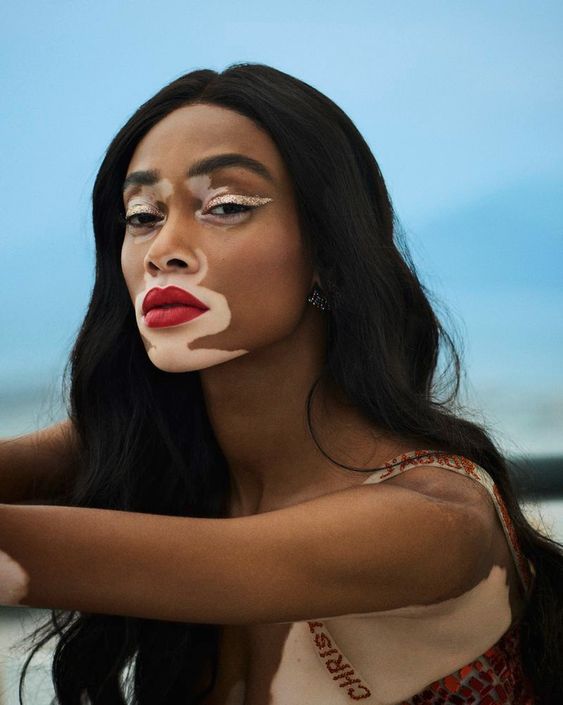 winnie harlow grazia uk 2018