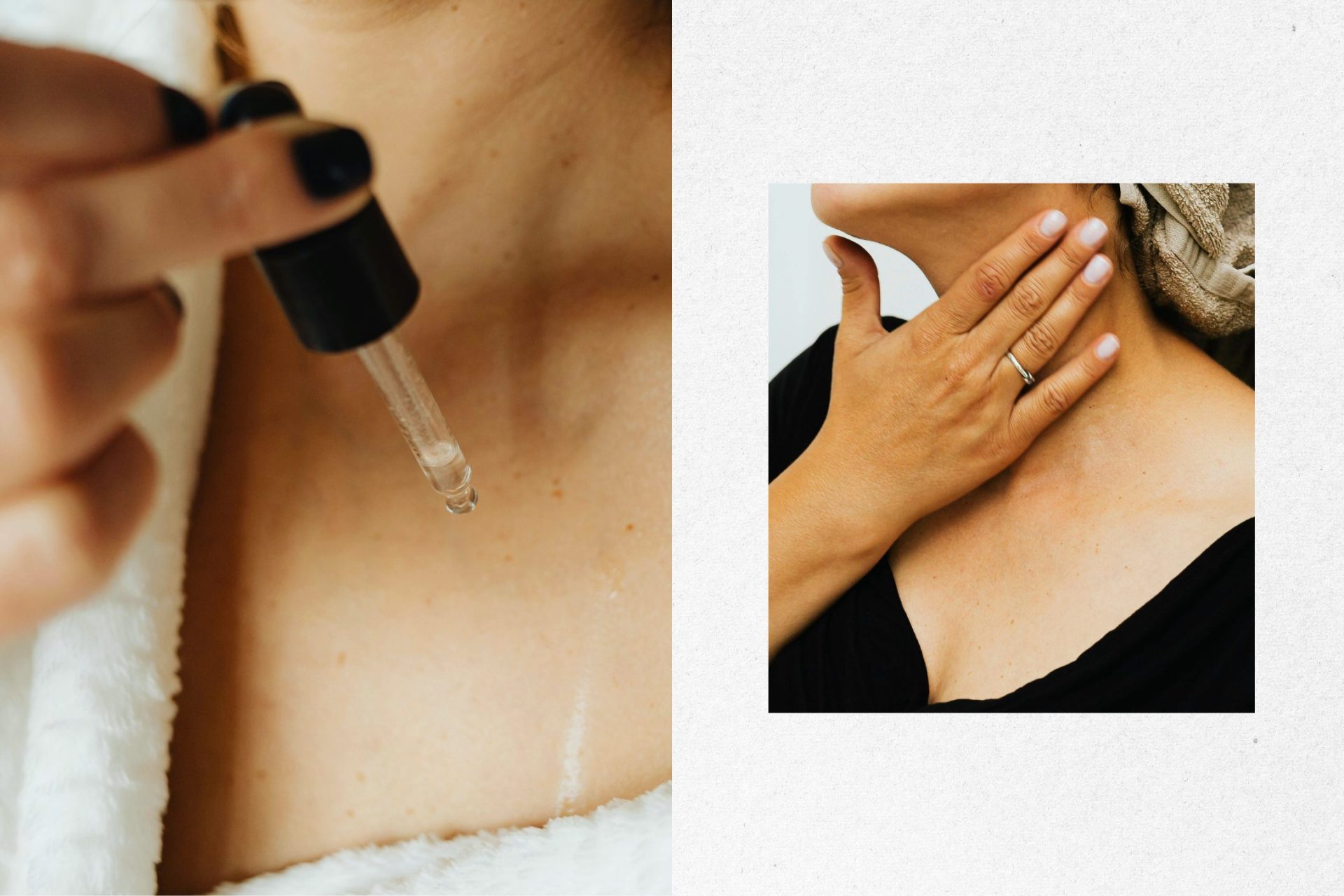 Sve prednosti vitamina E za lepotu i kako da ga unosite 1 1501